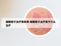 细胞因子治疗银屑病 细胞因子治疗属于什么治疗