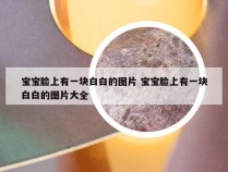 宝宝脸上有一块白白的图片 宝宝脸上有一块白白的图片大全