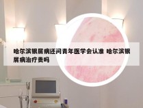 哈尔滨银屑病还问青年医学会认准 哈尔滨银屑病治疗贵吗