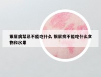 银屑病禁忌不能吃什么 银屑病不能吃什么食物和水果