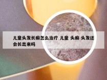 儿童头发长癣怎么治疗 儿童 头癣 头发还会长出来吗