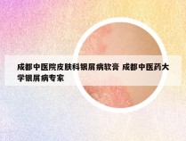 成都中医院皮肤科银屑病软膏 成都中医药大学银屑病专家