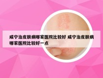 咸宁治皮肤病哪家医院比较好 咸宁治皮肤病哪家医院比较好一点