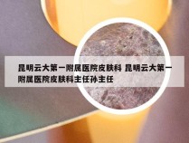 昆明云大第一附属医院皮肤科 昆明云大第一附属医院皮肤科主任孙主任