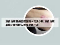 济南治银屑病正规医院人流多少钱 济南治银屑病正规医院人流多少钱一次