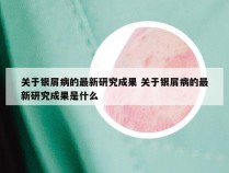 关于银屑病的最新研究成果 关于银屑病的最新研究成果是什么