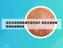 急性点滴状银屑病不及时治疗 急性点滴状银屑病消退期表现