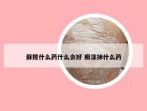 藓擦什么药什么会好 癣涂抹什么药