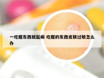 一吃腥东西就起癣 吃腥的东西皮肤过敏怎么办