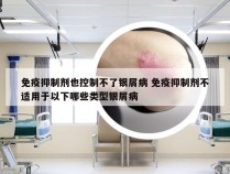 免疫抑制剂也控制不了银屑病 免疫抑制剂不适用于以下哪些类型银屑病