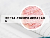 连翘败毒丸,百癣夏塔热片 连翘败毒丸治癣吗