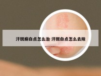 汗斑癣白点怎么治 汗斑白点怎么去除