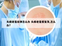 头癣老是反弹怎么办 头癣老是爱复发,怎么办?