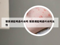 银屑病能喝桑叶水吗 银屑病能喝桑叶水吗女性