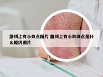 胳膊上有小白点图片 胳膊上有小白斑点是什么原因图片