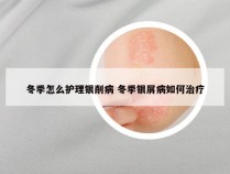 冬季怎么护理银削病 冬季银屑病如何治疗