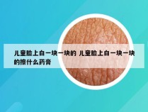 儿童脸上白一块一块的 儿童脸上白一块一块的擦什么药膏