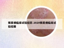 银屑病临床试验经历 2020银屑病临床试验招募