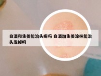 白酒和生姜能治头癣吗 白酒加生姜涂抹能治头发掉吗