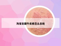 淘宝主图牛皮癣怎么去除