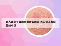 男人背上有白斑点是什么原因 男人背上有白色的小点