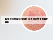 长春同仁堂皮肤科医院 长春同仁堂中医看的好吗