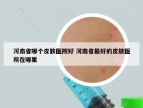 河南省哪个皮肤医院好 河南省最好的皮肤医院在哪里