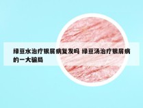 绿豆水治疗银屑病复发吗 绿豆汤治疗银屑病的一大骗局