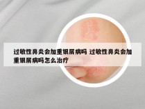 过敏性鼻炎会加重银屑病吗 过敏性鼻炎会加重银屑病吗怎么治疗