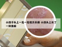 小孩子头上一处一处地方长癣 小孩头上长了一块像癣