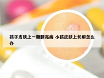 孩子皮肤上一颗颗亮癣 小孩皮肤上长癣怎么办