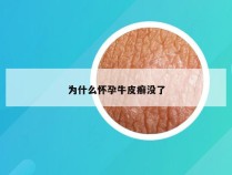 为什么怀孕牛皮癣没了