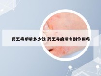 药王毒癣清多少钱 药王毒癣清有副作用吗