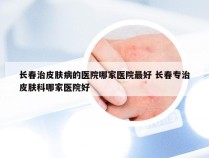 长春治皮肤病的医院哪家医院最好 长春专治皮肤科哪家医院好