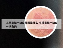 儿童皮肤一块白原因是什么 小孩皮肤一块白一块白的