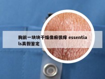 胸前一块块干燥像癣很痒 essentials真假鉴定