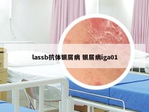 lassb抗体银屑病 银屑病iga01