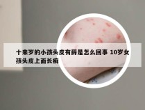 十来岁的小孩头皮有藓是怎么回事 10岁女孩头皮上面长癣