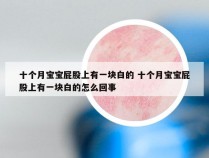 十个月宝宝屁股上有一块白的 十个月宝宝屁股上有一块白的怎么回事