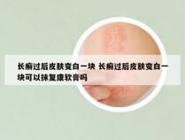 长癣过后皮肤变白一块 长癣过后皮肤变白一块可以抹复康软膏吗