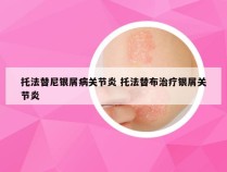 托法替尼银屑病关节炎 托法替布治疗银屑关节炎