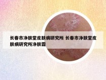 长春市净肤堂皮肤病研究所 长春市净肤堂皮肤病研究所净肤霜