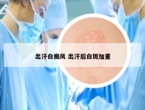 出汗白癜风 出汗后白斑加重