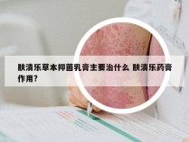 肤清乐草本抑菌乳膏主要治什么 肤清乐药膏作用?