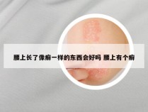 腰上长了像癣一样的东西会好吗 腰上有个癣