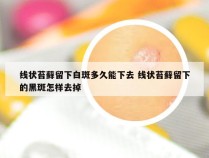 线状苔藓留下白斑多久能下去 线状苔藓留下的黑斑怎样去掉