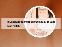 白点癫风用308准分子激光能好么 白点癫风治疗贵吗