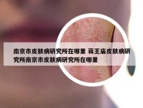 南京市皮肤病研究所在哪里 蒋王庙皮肤病研究所南京市皮肤病研究所在哪里