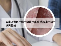 头皮上黄色一块一块是什么癣 头皮上一块一块黄色的