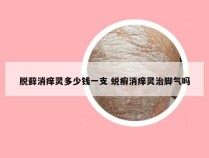 脱藓消痒灵多少钱一支 蜕癣消痒灵治脚气吗